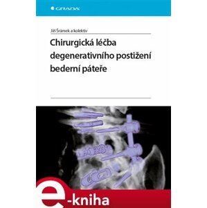 Chirurgická léčba degenerativního postižení bederní páteře - kolektiv autorů, Jiří Šrámek e-kniha