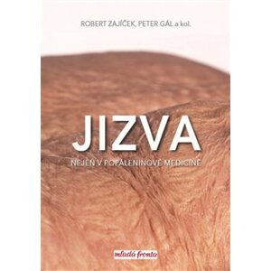 Jizva nejen v popáleninové medicíně - Robert Zajíček, Peter Gál