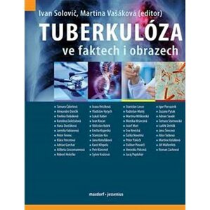 Tuberkulóza ve faktech i obrazech - kol., Ivan Solovič, Martina Vašáková