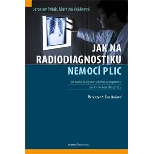 Jak na radiodiagnostiku nemocí plic - Jaroslav Polák