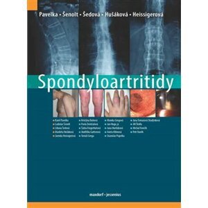 Spondyloartritidy - Jarmila Heissigerová, Liliana Šedová, Karel Pavelka, Ladislav Šenolt, Markéta Hušáková