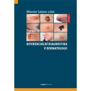 Diferenciální diagnostika v dermatologii - kol., Miloslav Salavec
