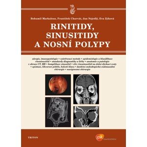 Rinitidy, sinusitidy a nosní polypy -  František Charvát