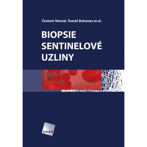 Biopsie sentinelové uzliny -  Tomáš Bohanes
