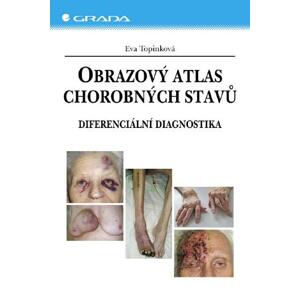 Obrazový atlas chorobných stavů -  Eva Topinková