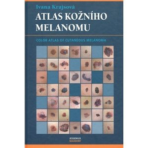 Atlas kožního melanomu -  Ivana Krajsová