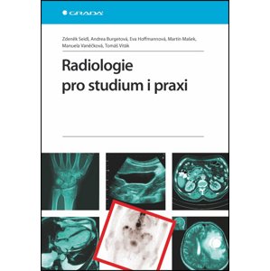 Radiologie pro studium i praxi -  Eva Hoffmannová
