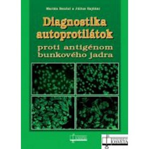 Diagnostika autoprotilátok proti antigénom bunkového jadra -  Marián Benčat