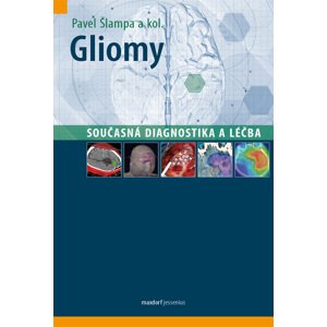 Gliomy - současná diagnostika a léčba -  Pavel Šlampa
