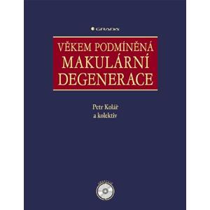 Věkem podmíněná makulární degenerace -  Irena Wagnerová
