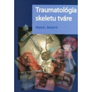 Traumatológia skeletu tváre -  Vladimír Machoň