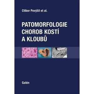Patomorfologie chorob kostí a kloubů -  Ctibor Povýšil