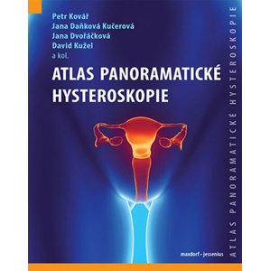 Atlas panoramatické hysteroskopie -  Jana Daňková Kučerová