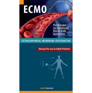 ECMO Extracorporeal membrane oxygenation -  Jan Bělohlávek