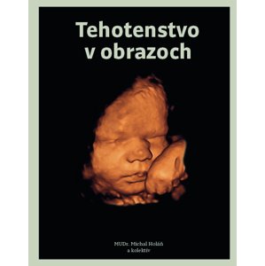Tehotenstvo v obrazoch -  Michal Holáň