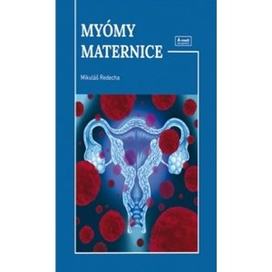 Myómy maternice -  Mikuláš Redecha
