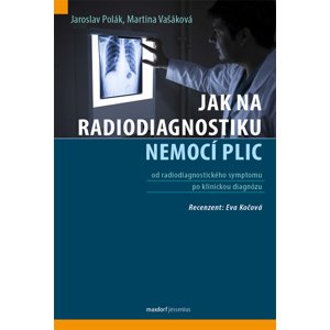Jak na radiodiagnostiku nemocí plic -  Martina Vašáková