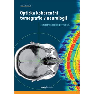Optická koherenční tomografie v neurologii -  Jana Lízrová Preiningerová