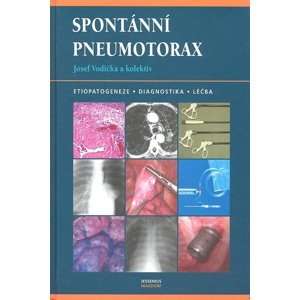Spontánní pneumotorax -  Josef Vodička