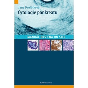 Cytologie pankreatu -  Jana Dvořáčková