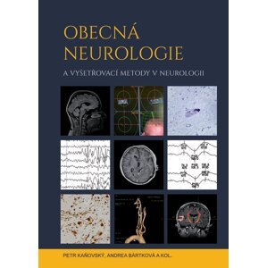 Obecná neurologie a vyšetřovací metody v neurologii -  Andrea Bártková