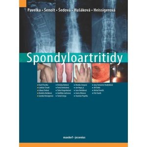 Spondyloartritidy -  Ladislav Šenolt