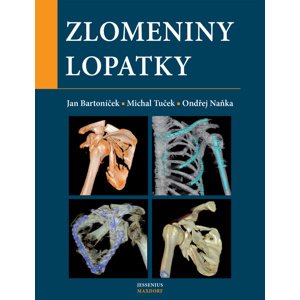 Zlomeniny lopatky -  Michal Tuček