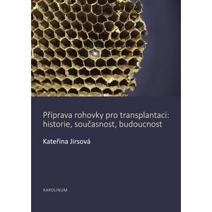 Příprava rohovky pro transplantaci -  Kateřina Jirsová