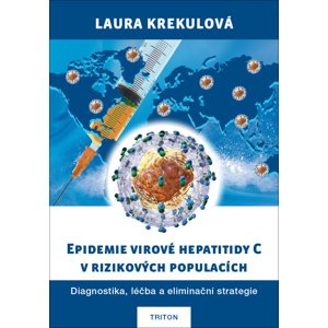 Epidemie virové hepatitidy C v rizikových populací -  Laura Krekulová