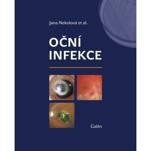 Oční infekce -  Autor Neuveden