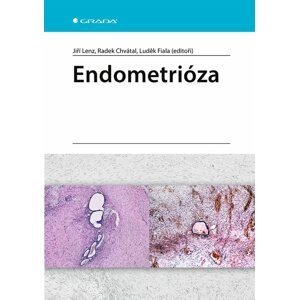 Endometrióza -  Jiří Lenz