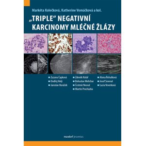 „Triple“ negativní karcinomy mléčné žlázy -  Markéta Kolečková