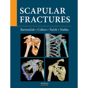 Scapular fractures -  Michal Tuček