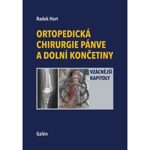 Ortopedická chirurgie pánve a dolní končetiny -  Radek Hart