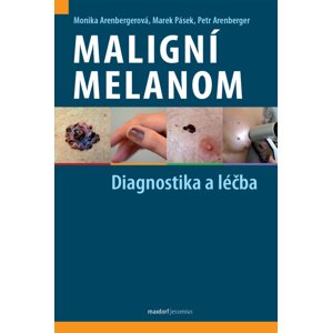 Maligní melanom -  Monika Arenbergerová