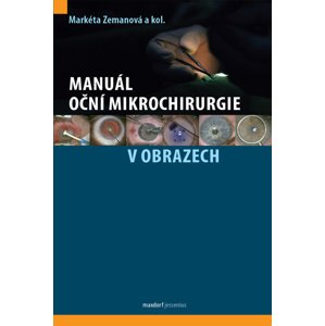 Manuál oční mikrochirurgie v obrazech -  Markéta Zemanová