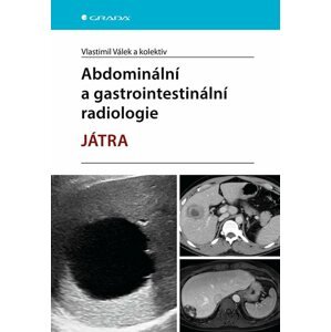 Abdominální a gastrointestinální radiologie -  Irena Wagnerová