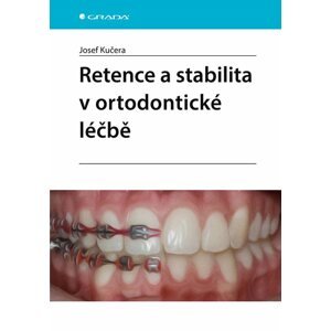 Retence a stabilita v ortodontické léčbě -  Josef Kučera